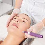 The best microneedling pen for your beauty salon